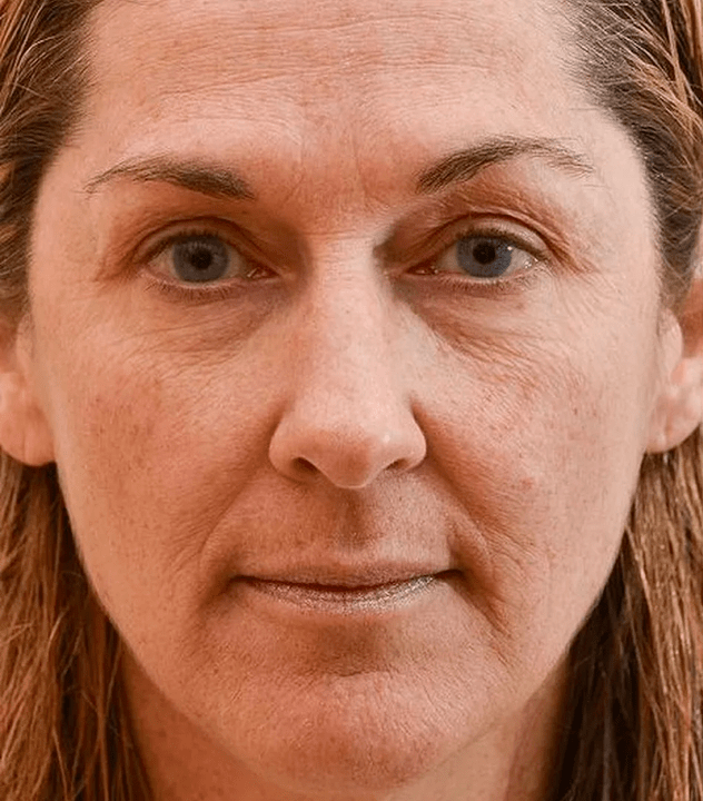 My face before the use of the Eudalie cream