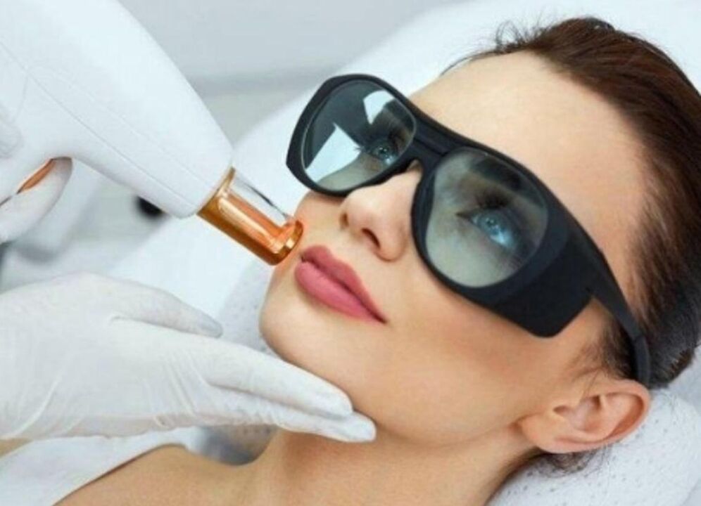 Skin rejuvenation of the skin