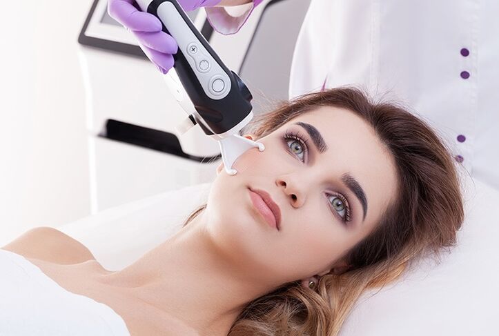 Laser rejuvenation