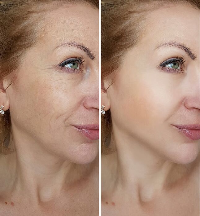 before and after